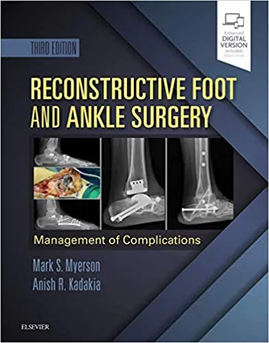 Reconstructive Foot and Ankle Surgery: Management of Complications 3rd Edition 2018 by Mark S. Myerson