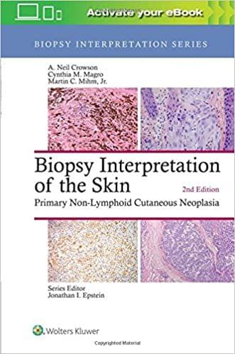 Biopsy Interpretation of the Skin 2nd Edition 2018 by A. Neil Crowson