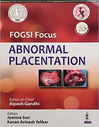 FOGSI Focus Abnormal Placentation 1st Edition 2020 by Gandhi Alpesh