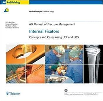 AO Manual of Fracture Management: Internal Fixators 1st Edition 2006 by Michael Wagner