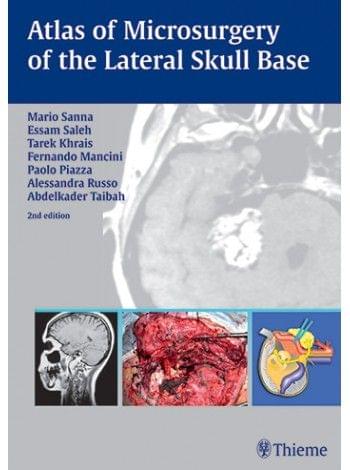 Atlas of Microsurgery of the Lateral Skull Base 2nd Edition 2008 by Sanna , Saleh