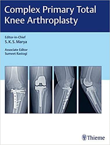 Complex Primary Total Knee Arthroplasty 1st Edition 2017 by Marya