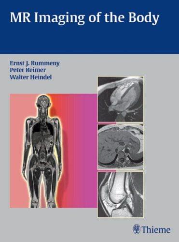 MR Imaging of the Body 1st Edition by Peter Reimer