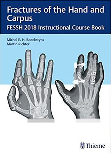 Fractures of the Hand and Carpus 1st Edition 2018 by Boeckstyns