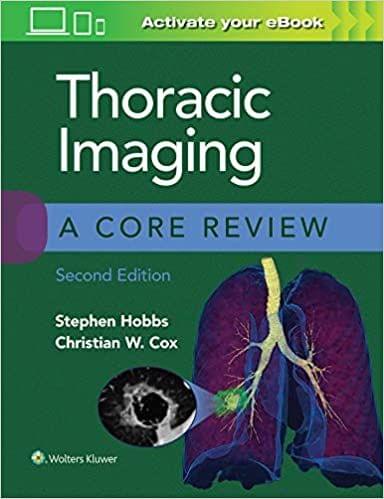 Thoracic Imaging: A Core Review 2nd Edition 2021 by Stephen Hobbs