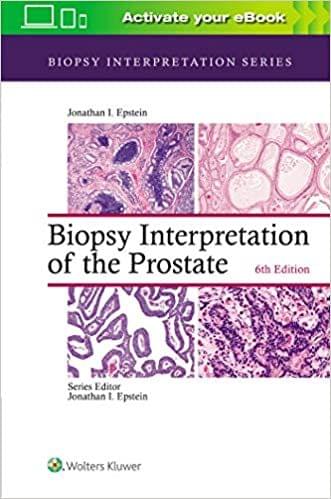 Biopsy Interpretation Of The Prostate 6th Edition 2021 by Jonathan I. Epstein
