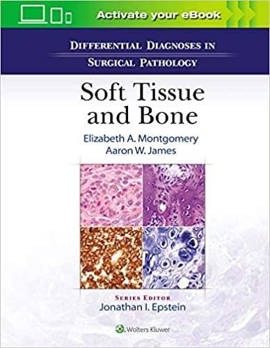Differential Diagnoses in Surgical Pathology: Soft Tissue and Bone 2021 by Elizabeth A. Montgomery