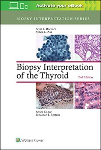Biopsy Interpretation Of The Thyroid 2nd Edition 2017 by Boerner S L