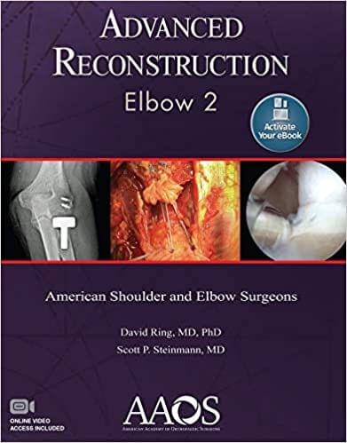 Advanced Reconstruction Elbow 2 American Shoulder And Elbow Surgeons 2016 by Ring D