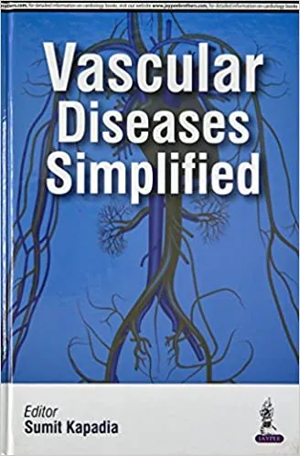 Vascular Diseases Simplified 1st Edition 2016 by Sumit Kapadia