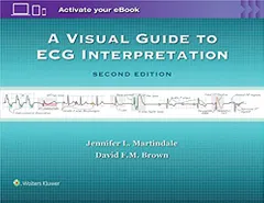 A Visual Guide to ECG Interpretation 2nd Edition 2016 by Jennifer L Martindale
