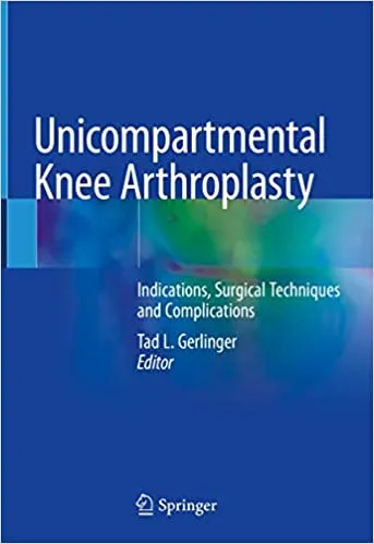 Unicompartmental Knee Arthroplasty: Indications, Surgical Techniques and Complications 2019 by Tad L. Gerlinger