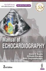 Manual of Echocardiography 2nd Edition 2022 By Navin C Nanda