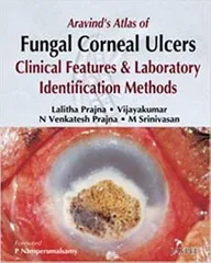 Aravind'S Atlas Of Fungal Corneal Ulcers Clinical Features & Lab.Identification Methods 1st Edition By Prajna