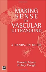 Making Sense Of Vascular Ultrasound A Hands-On Guide 1st Edition By Myers