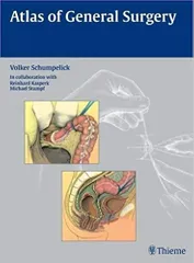 Atlas of General Surgery 2009 By Schumpelick