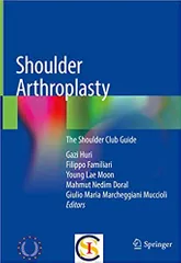 Shoulder Arthroplasty: The Shoulder Club Guide 2020 By Huri Publisher Springer