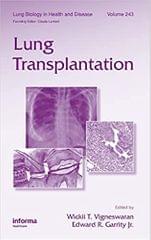 Lung Transplantation: Lung Biology in Health & Disease Series 2010 By Vigneswaran Publisher Taylor & Francis