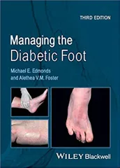 Managing the Diabetic Foot 3rd Edition 2014 By Edmonds Publisher Wiley