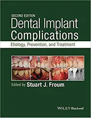 Dental Implant Complications: Etiology Prevention and Treatment 2nd Edition 2016 By Stuart J Froum