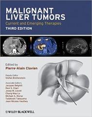 Malignant Liver Tumors: Current & Emerging Therapies 3rd Edition 2010 By Clavien Publisher Wiley