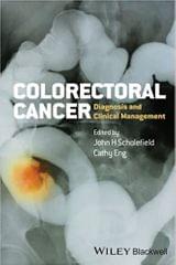 Colorectal Cancer: Diagnosis & Clinical Management 2014 By Scholefield Publisher Wiley
