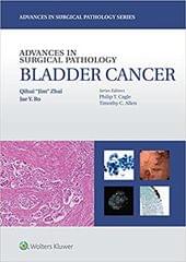 Advances In Surgical Pathology Bladder Cancer 2016 By Zhai Q J