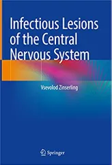 Infectious Lesions Of The Central Nervous System 2022 By Zinserling V