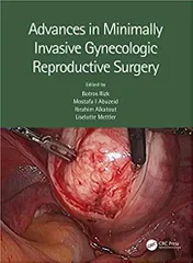 Advances In Minimally Invasive Gynecologic Reproductive Surgery 2022 By Rizk B
