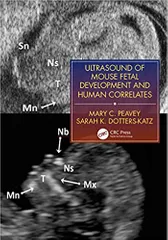 Ultrasound Of Mouse Fetal Development And Human Correlates 2021 By Peavey Mary C