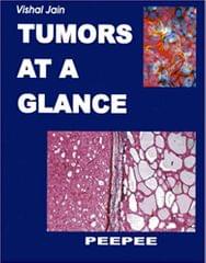 Tumors At A Glance For Dm Oncology 1st Edition 2013 By V K Jain