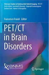 Fraioli F PET/CT In Brain Disorders 2019