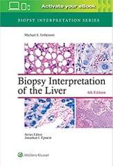Torbenson M S Biopsy Interpretation Of The Liver With Access Code 4th Edition 2022