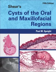 Shear's Cysts of the Oral and Maxillofacial Regions 5th Edition 2022