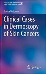 Tiodorovic Clinical Cases in Dermoscopy of Skin Cancers 1st Edition 2020