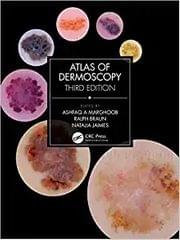 Ashfaq A Marghoob Atlas of Dermoscopy 3rd Edition 2023