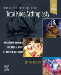 Mihalko W M  The Technique Of Total Knee Arthroplasty With Access Code 2nd Edition 2023