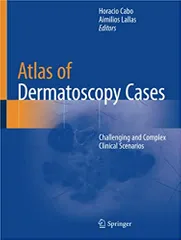 Cabo H Atlas Of Dermatoscopy Cases Challenging And Complex Clinical Scenarios 2020