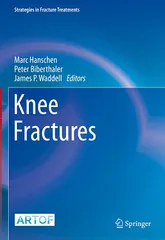 Hanschen M Knee Fractures 2021