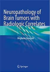 Chougule M Neuropathology Of Brain Tumors With Radiologic Correlates 2020