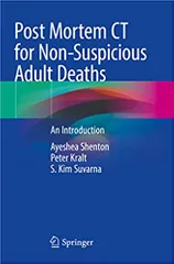Shenton A Post Mortem Ct For Non Suspicious Adult Deaths An Introduction 2021
