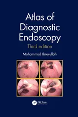Mohammad Ibrarullah Atlas of Diagnostic Endoscopy 3rd Edition 2021