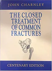 The Closed Treatment Of Common Fractures by John Charnley 2019