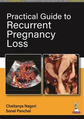 Practical Guide To Recurrent Pregnancy Loss 1st Edition 2023 By Chaitanya Nagori