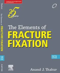 The Elements Of Fraction And Fixations 5th Edition 2023 By Anand J Thakur