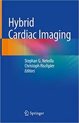 Hybrid Cardiac Imaging  2022 By Nekolla S.G.