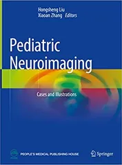 Pediatric Neuroimaging Cases And Illustrations  2022 By Liu H.