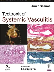 Textbook of Systemic Vasculitis 2nd Edition 2023 by Aman Sharma