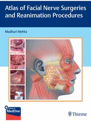 Atlas of Facial Nerve Surgeries and Reanimation Procedures 1st Edition 2023 by Mehta