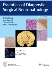 Essentials of Diagnostic Surgical Neuropathology 2nd Edition 2023 by Chitra Sarkar